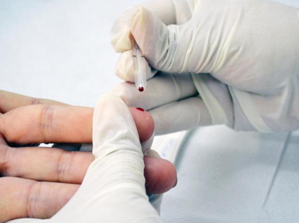 No mês de combate às hepatites virais, Hospital Helvio Auto oferece testagem aberta à população