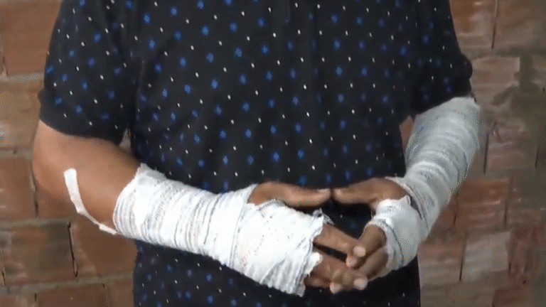 Motorista que disse ter sido sequestrado e queimado vivo forjou crime para fraudar seguro, afirma Polícia Civil